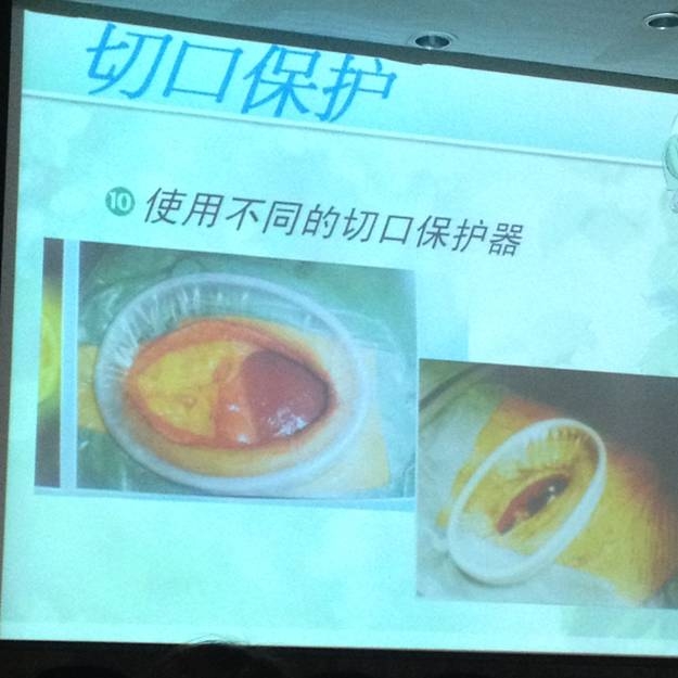 手术切口保护1.jpg