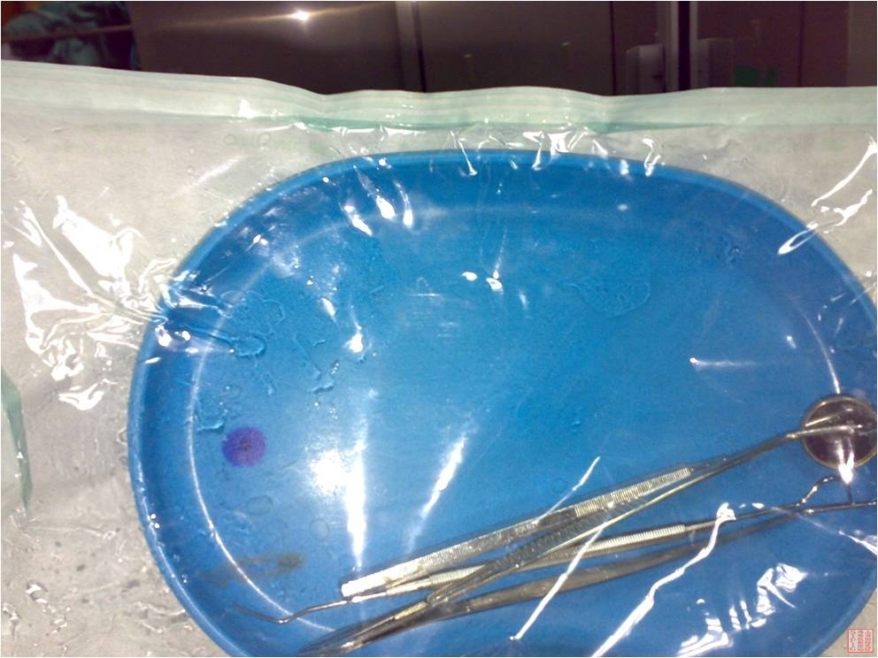 换药碗盘中塑料袋内的水珠