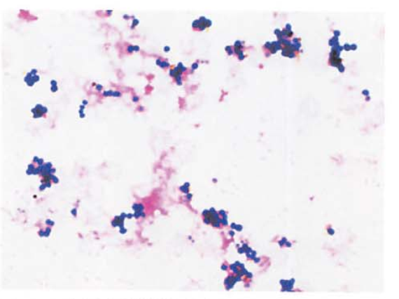 快速诊断血流感染的数十种检测方法大盘点！